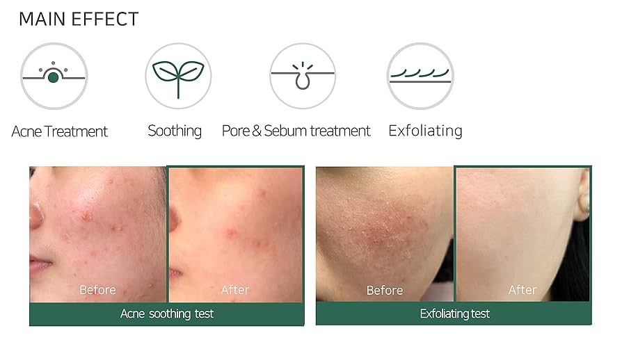 Some By Mi AHA BHA PHA 30 Days Miracle Acne Clear Foam Rose Cosmetics