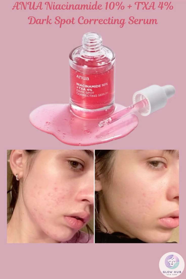 Anua, Niacinamide 10% + TXA 4% Dark Spot Correcting Serum Rose Cosmetics