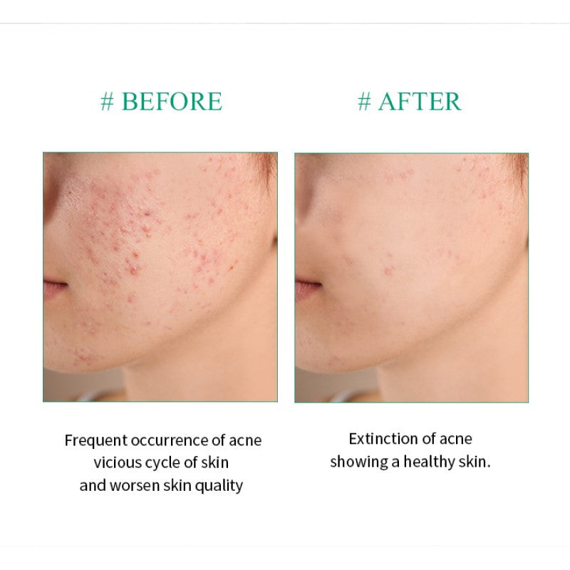 AHA.BHA.PHA 30 Days Miracle Travel Kit Rose Cosmetics