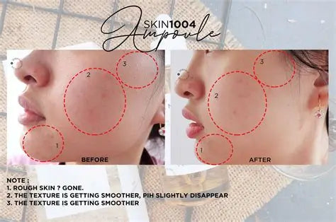Centella Tone Brightening Capsule Ampoule Rose Cosmetics