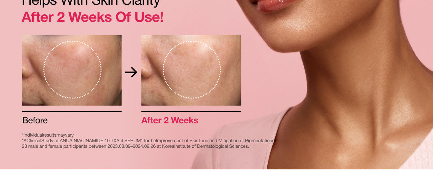 Anua, Niacinamide 10% + TXA 4% Dark Spot Correcting Serum Rose Cosmetics