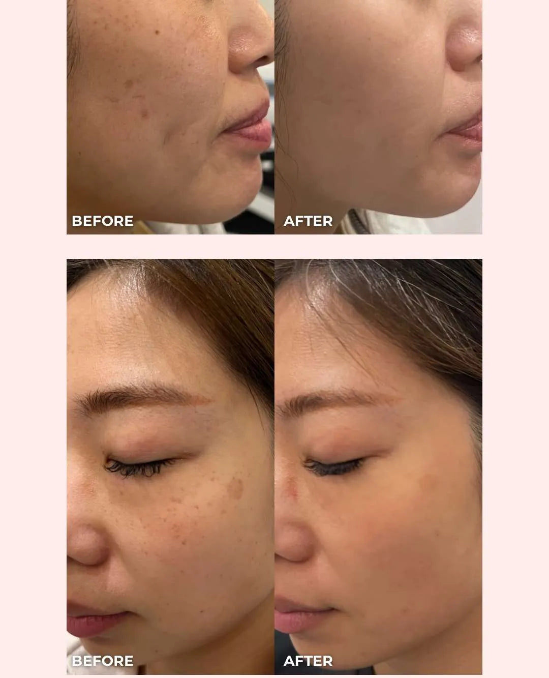 SOME BY MI - Yuja Niacin 30 Days Brightening Starter Kit 4 pcs Rose Cosmetics