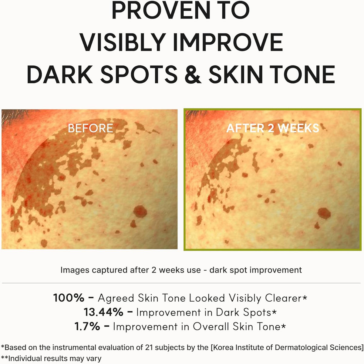 Arencia Booster Shot — 50% OFF Beauty House