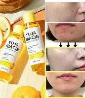 SOME BY MI - Yuja Niacin 30 Day Miracle Brightening Toner Rose Cosmetics