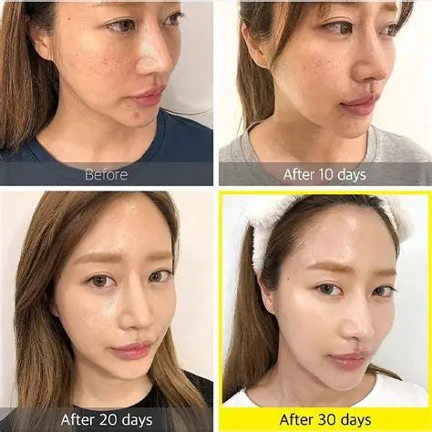 SOME BY MI - Yuja Niacin 30 Days Brightening Starter Kit 4 pcs Rose Cosmetics