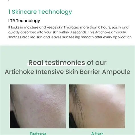 Artichoke Intensive Skin Barrier Ampoule Rose Cosmetics
