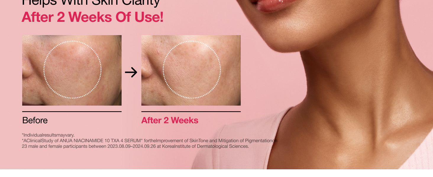 Anua, Niacinamide 10% + TXA 4% Dark Spot Correcting Serum Rose Cosmetics